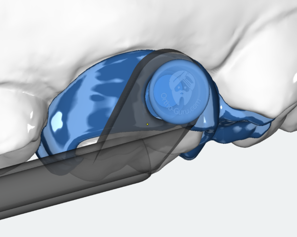 Herbst - laserfree SLM version