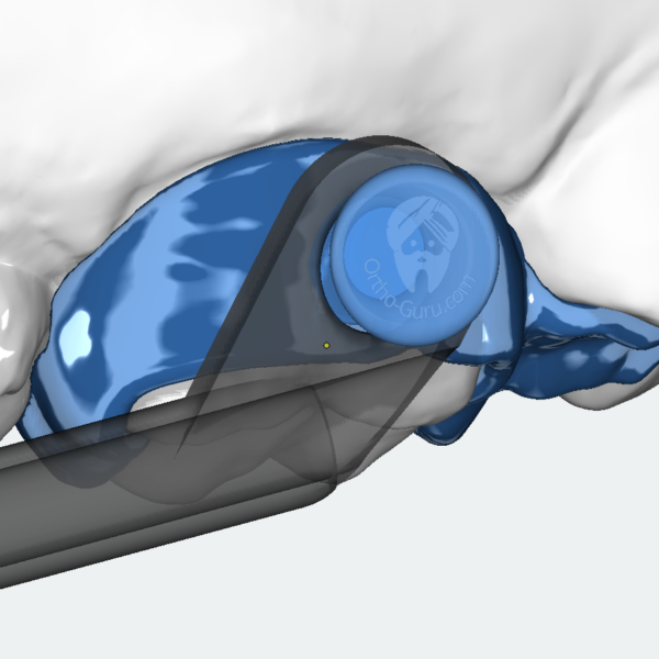 Herbst - laserfree SLM version