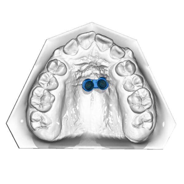 Resin printed Connector after RPE