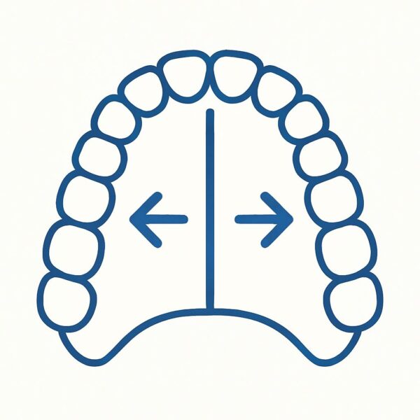 Palatal Expansion Devices
