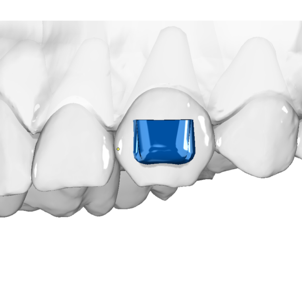 Horizontal Attachment