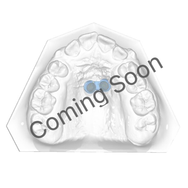 Resin printed Connector after RPE