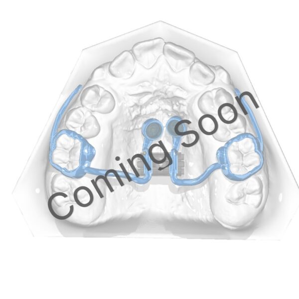 RPE - Hybrid - MARPE